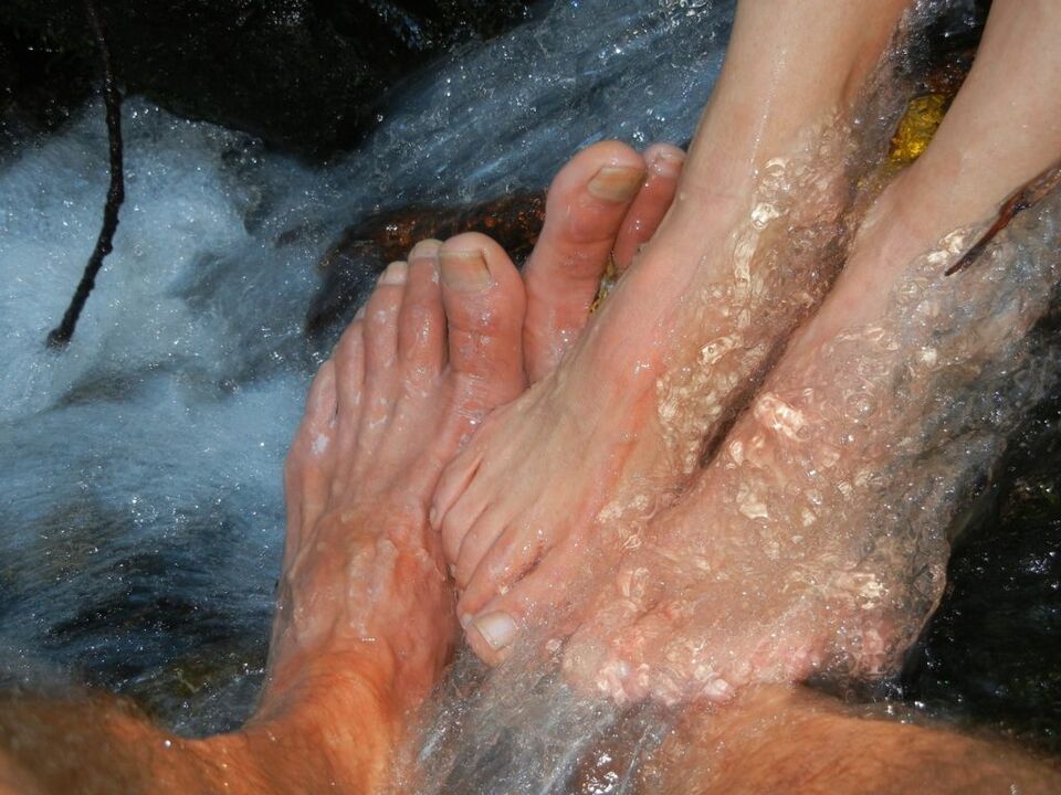 Micose das unhas das pernas
